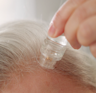 Calvita® - Technologie Capillaire  MicronInfuse Femme